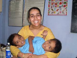 ЧУДО! Сиамски близнаци живеят в едно тяло 9 години (ВИДЕО)