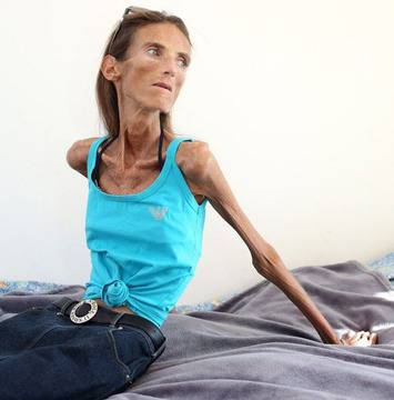 Живата мумия Валерия: Да си имаме едно наум за манипулациите (снимки)