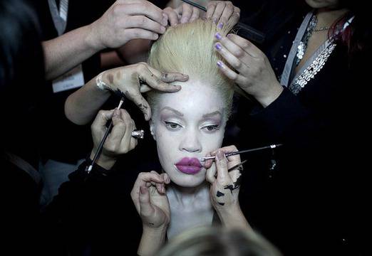 Африканка албинос е новата сензация в нета (снимки)