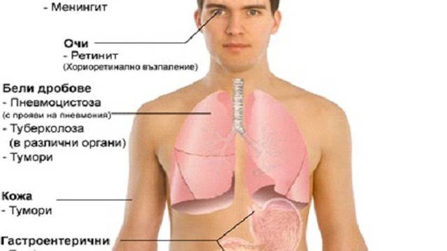 Онлайн ХИВ тест за наше улеснение