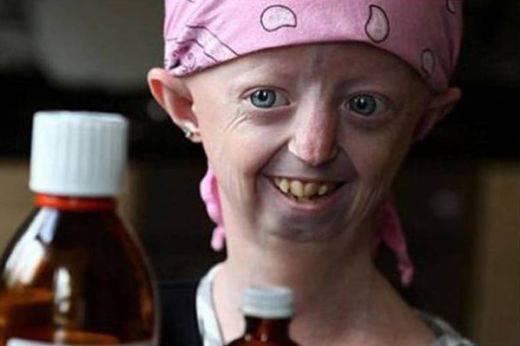 УЖАС! Тийнейджърка изглежда като 100-годишна баба