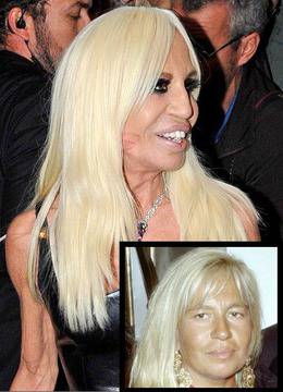 Шокиращи снимки! Звездни жертви на пластичната хирургия (Галерия)