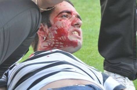 Наръгаха фен при меле в Борисовата градина