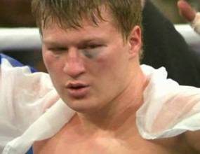 Поветкин: Кличко манипулират феновете