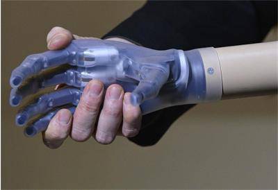Присаждат бионична ръка, която може да усеща
