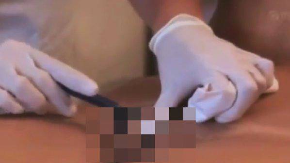 Епилация на женски полов орган в новинарска емисия (видео 18+)