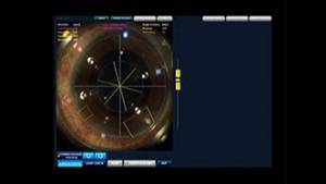 Открит е първият в България 3D лазер за операция на катаракта