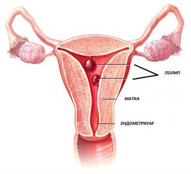 Превенция срещу миома