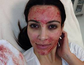 Ким Кардашян с окървавено лице