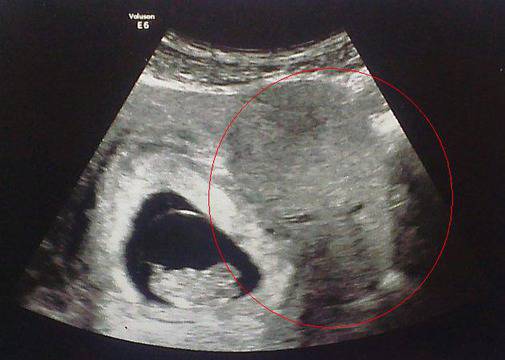 УНИКАЛНО! Ехограф засне ангел пазител