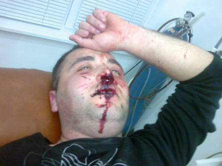 Втора Катуница назрява в Златоград