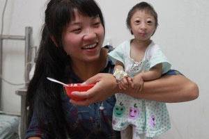 Най-малкото момиче на света тежи само един килограм!