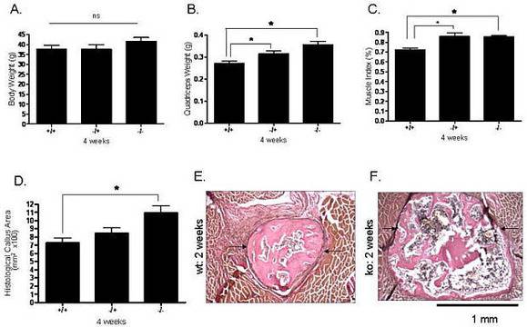 Миостатинови инхибитори