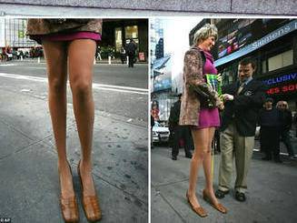 Хората с най-абсурдни телесни аномалии