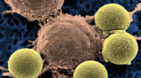 Учени направиха голям пробив в ранното откриване на рак