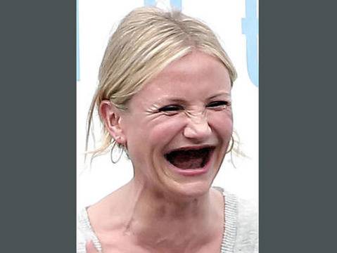 Вижте как изглеждат най-големите холивудски звезди без зъби!