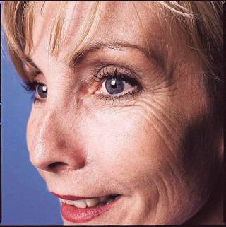 СтатияКак да се Справим с Бръчките