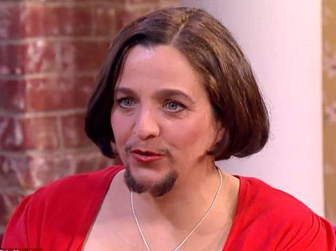 Вижте защо тази жена има брада