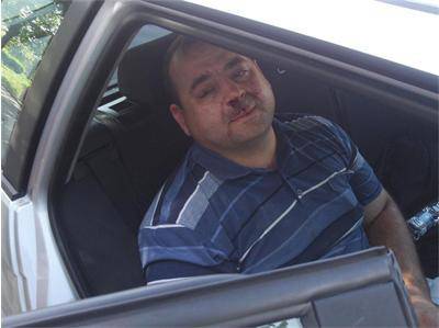 Четирима от ДПС пребиха жестоко човек на Касим Дал