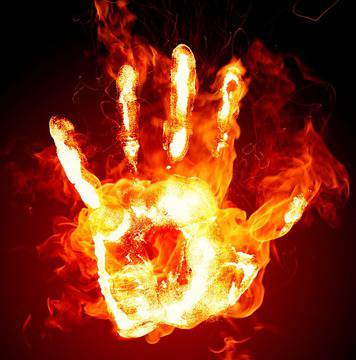 Първа помощ при изгаряне!