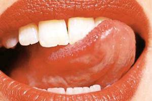 Видът на езика показва диагнозата