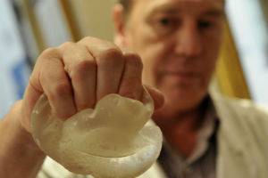 Касапин вкара силикон за матраци в гърдите на пациентка