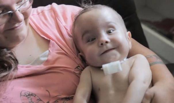 Имплант от 3D принтер спасява бебе