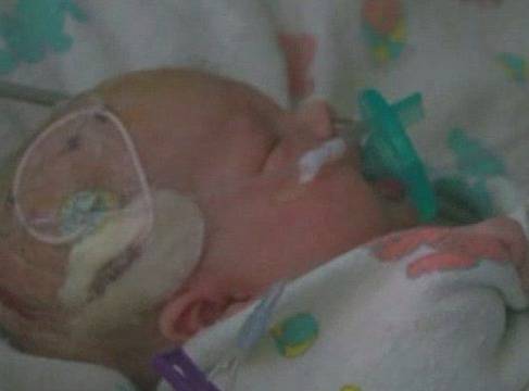 Лекар залепи мозъка на бебе с каноколит!