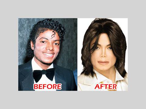 Десетте най-добри примери за най-лоши пластични операции (СНИМКИ)