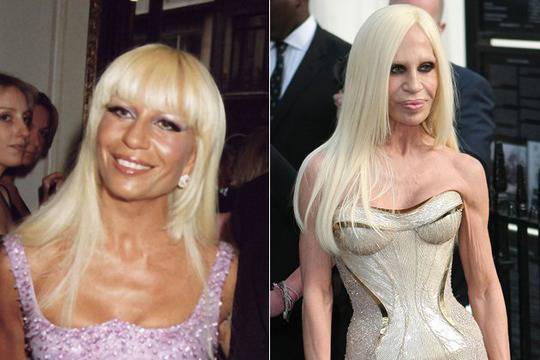 Вижте Донатела Версаче преди пластиките