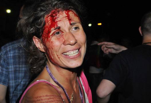 Окървавената жена от протеста: Орешарски, love, GIVE IT UP! видяна 8546 коментари 27