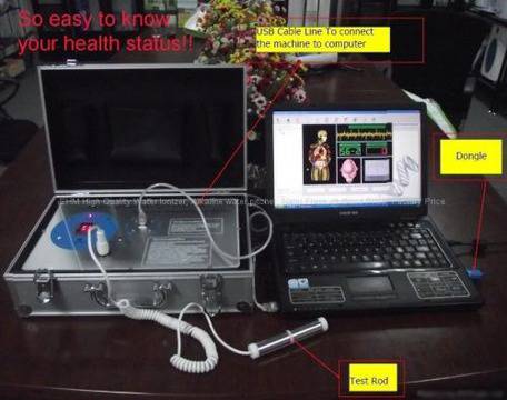 КВАНТОВ АНАЛИЗАТОР /БИОСКЕНЕР/ – ВИСОКОТЕХНОЛОГИЧЕН АПАРАТ ЗА КОМПЮТЪРНА ДИАГНОСТИКА НА ЗДРАВОСЛОВНОТО СЪСТОЯНИЕ.