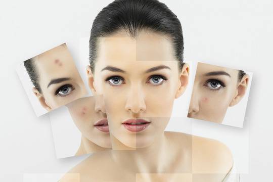 Митове и легенди за пъпките