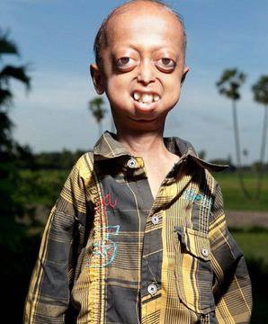 14-годишно дете е заточено в тялото на 110-годишен изрод