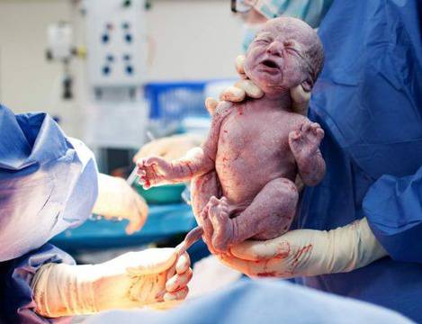 Д-р Петър Угрински: 13-14-годишни деца вече си имат бебета!