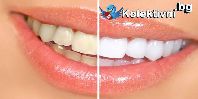София: Най-красивата усмивка! Преглед, Почистване на зъбен камък, Полиране и Бонус в Дентален кабинет Д-р Снежина Цекова!