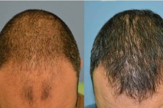 Инвестиция за цял живот