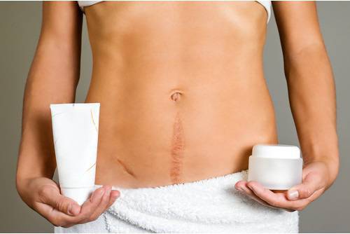 Премахване на белези