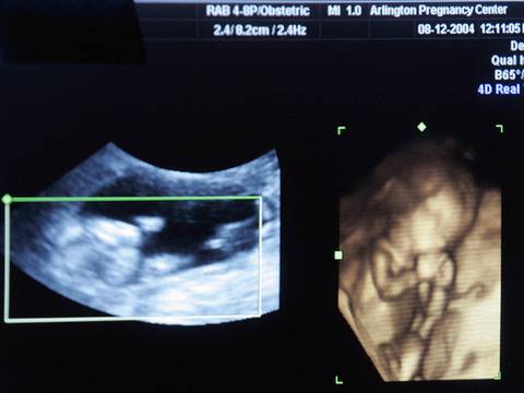 Важни витамини и аминокиселини за зачеване