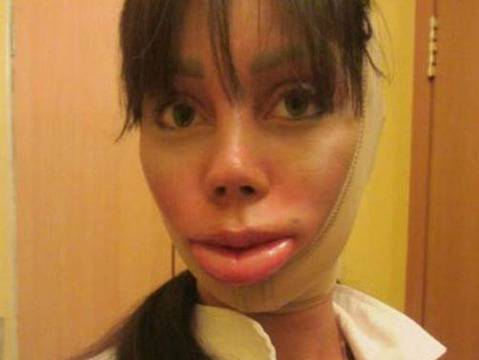 Ужасът на пластичната хирургия (СНИМКИ)