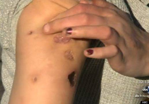 Расте разпространението на руската дрога Крокодил, жертви показват разядените си тела