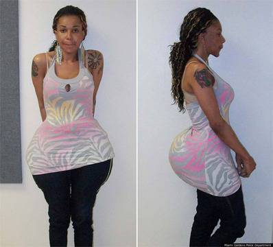 За красотата отзад и нейните трансексуални жертви