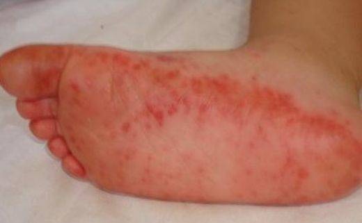 Миризливи китайски пантофи разраняват краката на бургазлии