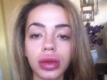 Кандидатка за Мис България се обезобрази с процедура за 50 лева