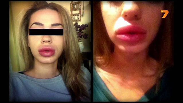 Опасностите при мнимите пластични операции