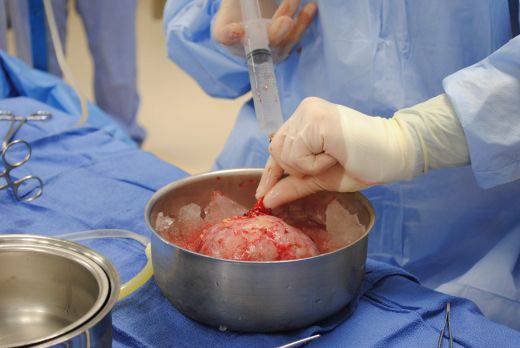 Проф. д-р Емил Паскалев: Вече има биомедикамент, който възстановява болния бъбрек!