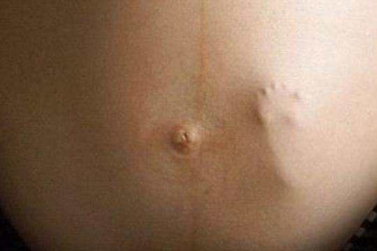 Как бебчо се забавлява в корема на мама