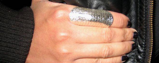 Сребърните бижута лекуват