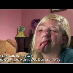 Момиче получи чисто ново лице 2350