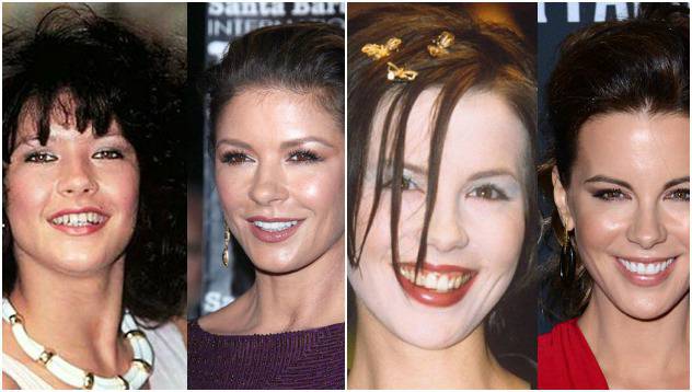 Звезди с лоши зъби видяна 7333 коментари 6